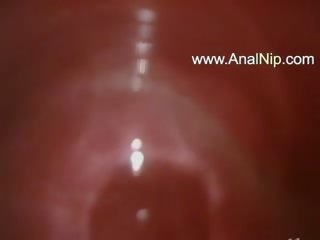 Sweet jap anal hairy dirty clip